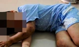 Bé gái 5 tuổi bị bố dượng hờ dùng ớt tươi hành hạ