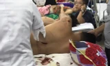 Nạn nhận bị chém hơn chục nhát