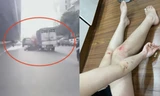Cô gái Hà Nội kể phút bị xe tải đe dọa 'mày tin tao đâm không' rồi húc ngã