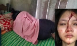 Lộ nguyên nhân nữ sinh Huế bị bạn cùng trường đánh chấn động não