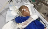 Bé trai qua cơn nguy kịch sau ca phẫu thuật kéo dài
