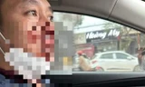 Thầy giáo bị hành hung, cướp tài sản trên đường