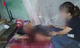 Bà Nguyễn Thị T. bị đa chấn thương và tử vong do chồng đánh ghen