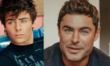 Fans tá hỏa vì gương mặt 'hoàng tử Disney' Zac Efron cứng đơ như búp bê Ken