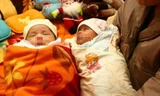 Cặp song sinh ra đời bằng tinh trùng lấy từ tử thi
