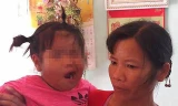 Bé 3 tuổi liệt dây thần kinh số 7 nghi do cô giáo đánh ở Thanh Hóa