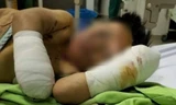 Bé trai tám tuổi thương tích nặng, cụt hai tay sau tiếng nổ lớn