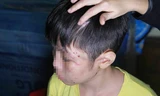 Tin nóng 24H: Cuộc sống đọa đầy của bé trai nghi bị bố bạo hành