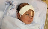 Hành trình cứu chữa bé trai 11 ngày tuổi bị đâm xuyên sọ
