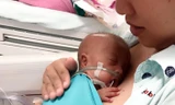 Bé trai 24 tuần nặng 600gr được cứu sống thần kỳ