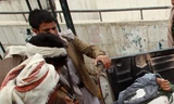 Chuyển nạn nhân trong vụ đánh bom ở Sanaa. Ảnh minh họa. (Nguồn: AFP/TTXVN)
