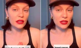 Jessie J thông báo mắc ung thư vú giai đoạn đầu, sẽ tạm nghỉ hát để chữa trị