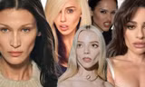 Sao Âu Mỹ sau thủ thuật lấy mỡ má: Bella Hadid nâng tầm nhan sắc, Liam Payne khác lạ
