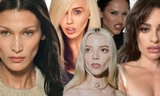 Sao Âu Mỹ sau thủ thuật lấy mỡ má: Bella Hadid nâng tầm nhan sắc, Liam Payne khác lạ