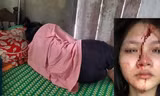 Nhiều vụ học sinh đánh nhau, ngành giáo dục ‘chẩn bệnh’ bạo lực học đường