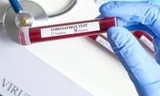 Vì sao bệnh nhân COVID-19 có thể dương tính lại sau 2 lần âm tính?