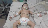 Bé H.H.Ng. đang hôn mê tại bệnh viện
