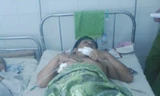 Nạn nhân Trương Văn Chính đang điều trị tại Bệnh viện ĐKTW Cần Thơ