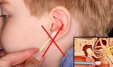 Những cách lấy ráy tai sai lầm có thể khiến bạn điếc vĩnh viễn
