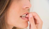 Thói quen cắn móng tay có thể gây ra những bệnh nghiêm trọng mà bạn không ngờ tới