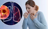 Những người này dù không hút thuốc cũng cực dễ bị ung thư phổi 'gõ cửa' 