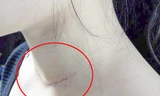 Vết thương trên cổ nạn nhân. Ảnh: CTV.