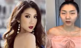 'Hốt hoảng' trước gương mặt khác lạ khó tin của siêu mẫu Ngọc Quyên, thực hư ra sao? 