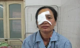 Bệnh nhân bị mất thị lực vĩnh viễn mắt bên phải.