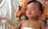 Bé Hải được cho là bị cha dượng đánh vỡ đại tràng. Ảnh: Nguyệt Triều.