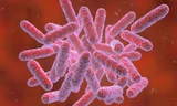 Bệnh Whitmore gây ra bởi vi khuẩn Burkholderia pseudomallei. Ảnh minh hoạ