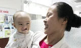 Dự kiến 300 trẻ bị khe hở môi, vòm miệng sẽ được phẫu thuật miễn phí trong tháng 10. 