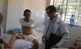 Bệnh nhân bị bỏng điện phải đoạn chi. Ảnh do bệnh viện cung cấp.