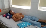 Nạn nhân Trần Xuân Hưng điều trị tại bệnh viện.