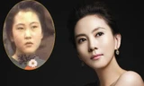 Những sao Hàn đẹp hơn nhờ phẫu thuật thẩm mỹ