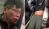 Vị bác sĩ gốc Việt bị kéo lê trên máy bay của hãng United Airlines.