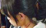 Vết thương trên cổ cháu Linh.