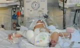 Đau đớn tháo khớp gối bé sơ sinh gặp tai nạn thảm khốc