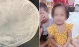 Bản tin 8H: Bé 3 tuổi bị đóng đinh vào đầu đã qua cơn nguy kịch