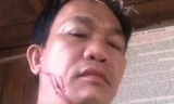 Kiểm lâm viên Nguyễn Thà bị chém rách mặt