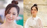 Lương Bích Hữu: Đường tình duyên lận đận, từng bị bỏng nặng đến mức phải tạm dừng ca hát