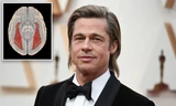 Showbiz 7/7: Nguy hiểm từ hội chứng mù mặt của Brad Pitt