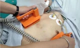 Hơn 30 lần sốc điện cứu bệnh nhân thoát khỏi 'cơn bão điện học'