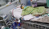 Bé trai béo phì mắc COVID-19 nguy kịch vì 'bão Cytokine'