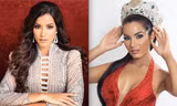 Tân Hoa hậu Siêu quốc gia Venezuela lộ diện: body cực sexy nhưng gương mặt bị chê 'già trước tuổi'