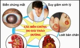 Biến chứng kép tim mạch – võng mạc ở bệnh nhân tiểu đường: Có thể ngăn chặn từ sớm