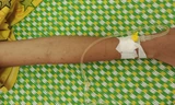 Những vết rạch chi chít trên cánh tay bệnh nhi ở Cao Bằng
