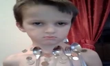 Bé Erman Delic có thể hút nhiều đồ vật kim loại như thìa, nĩa, đồng xu. Ảnh: CEN.