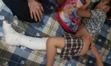 Vết thương của cháu Kiên