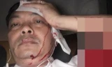 Ông Nguyễn Văn Đông ôm đầu tóe máu do bị tấn công.