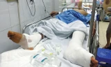 Bệnh nhân Trần Văn Thảo sau khi bị mổ nhầm chân. Ảnh: Thái Hà.
